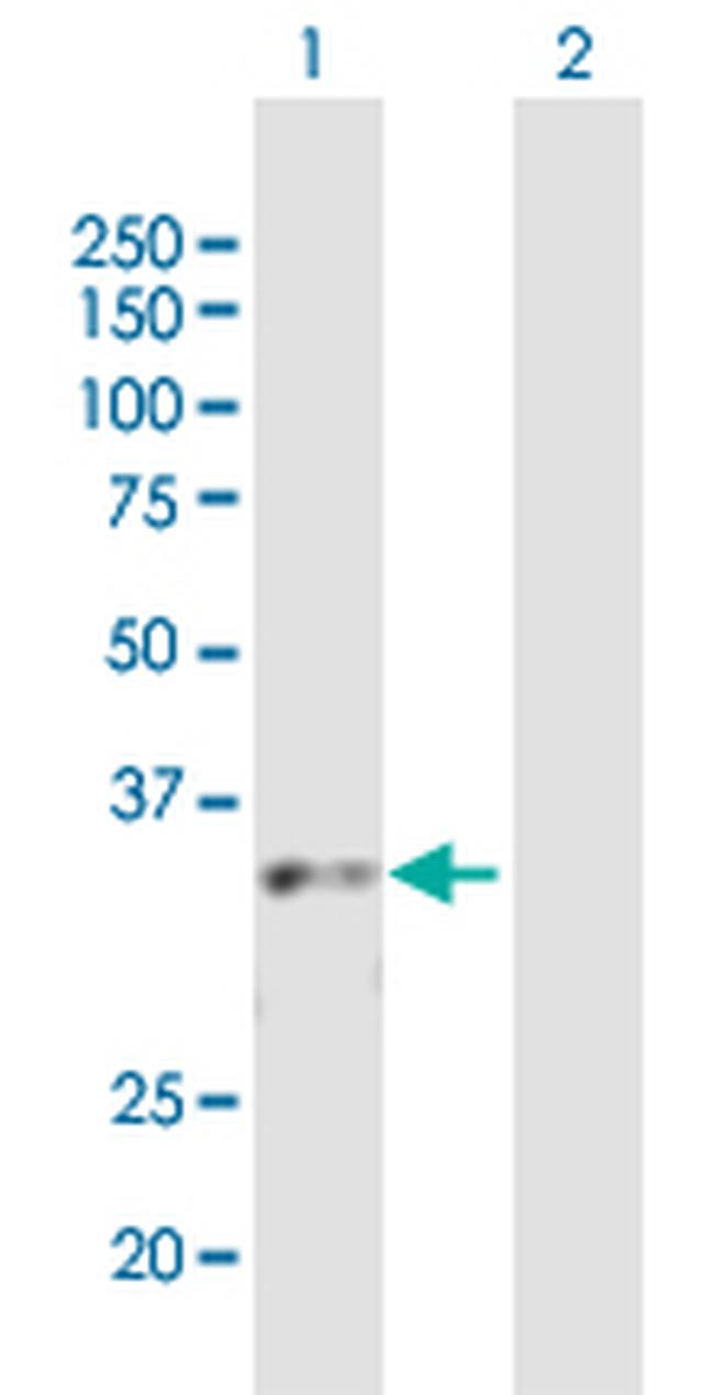 CBX7 Antibody in Western Blot (WB)