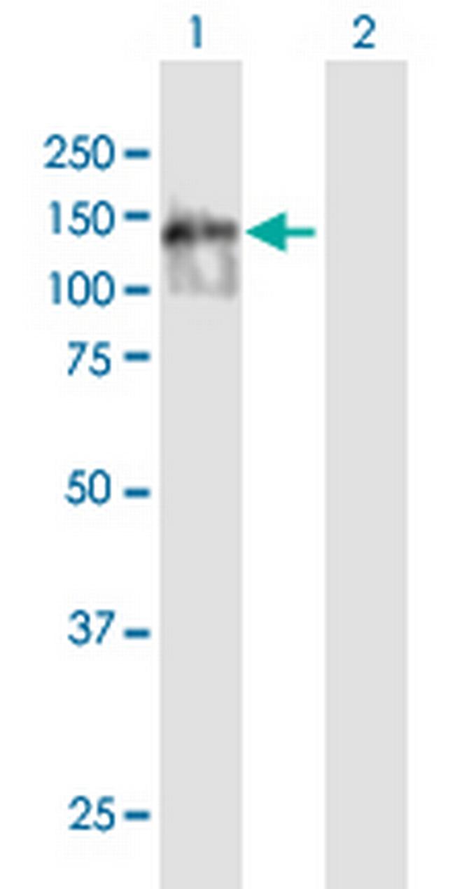 KIAA0146 Antibody in Western Blot (WB)
