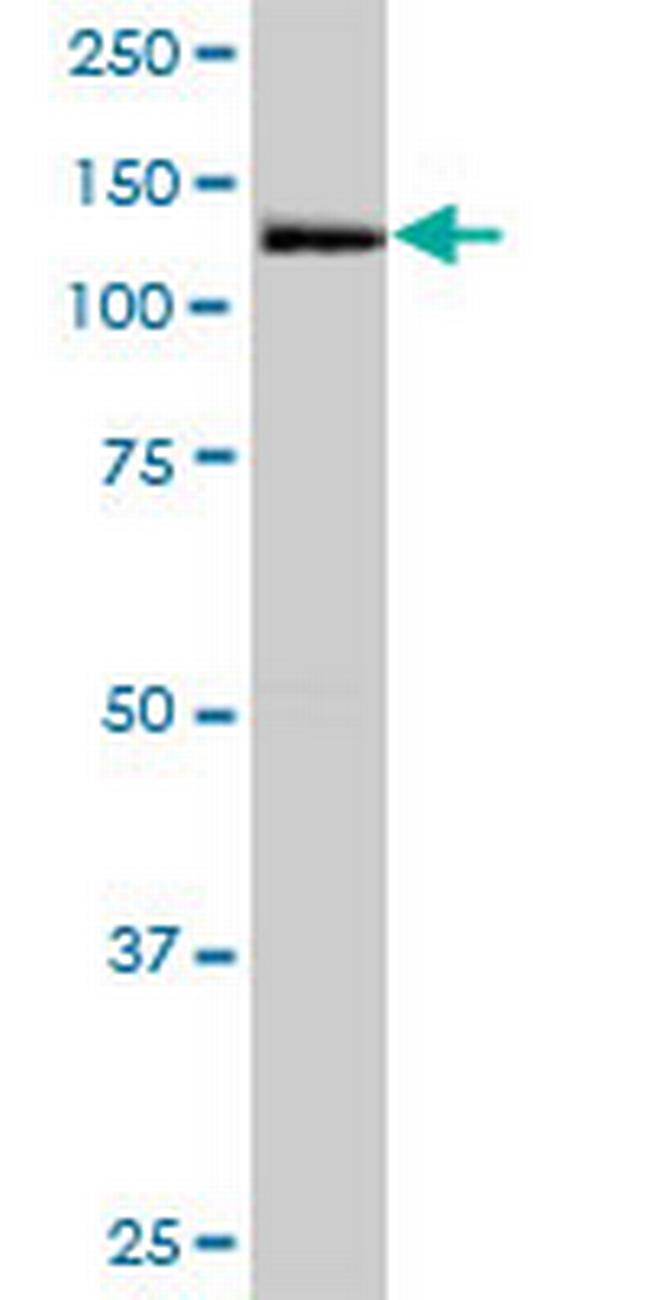 MORC3 Antibody in Western Blot (WB)