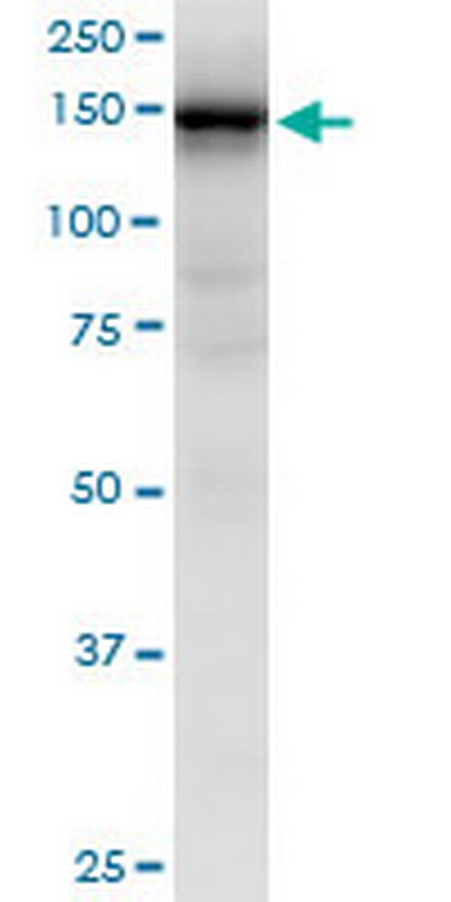 HMHA1 Antibody in Western Blot (WB)
