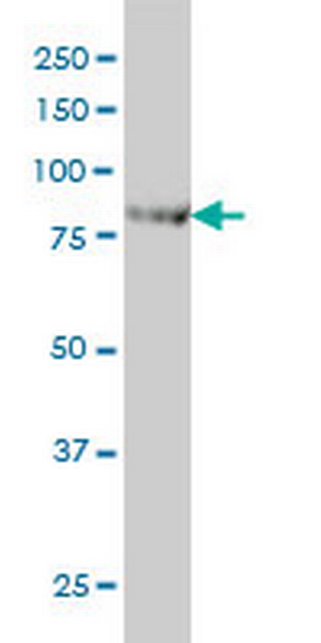 CENTB2 Antibody in Western Blot (WB)