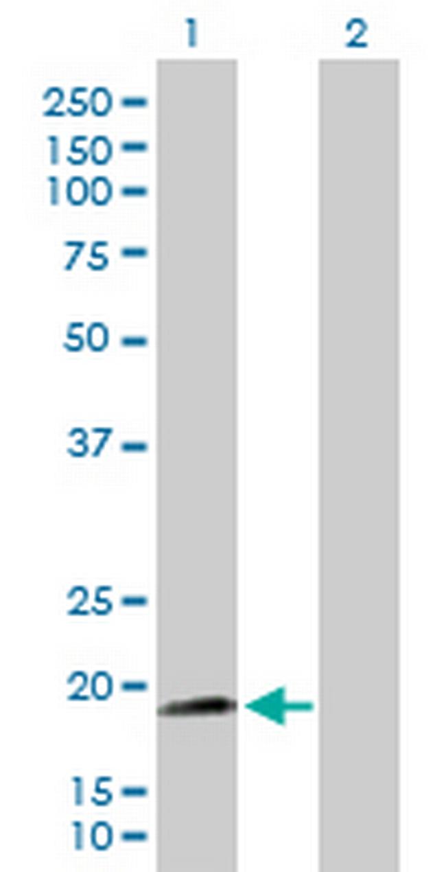 NNT Antibody in Western Blot (WB)