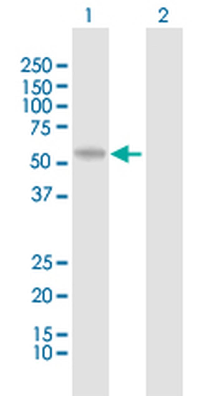 PRAME Antibody in Western Blot (WB)
