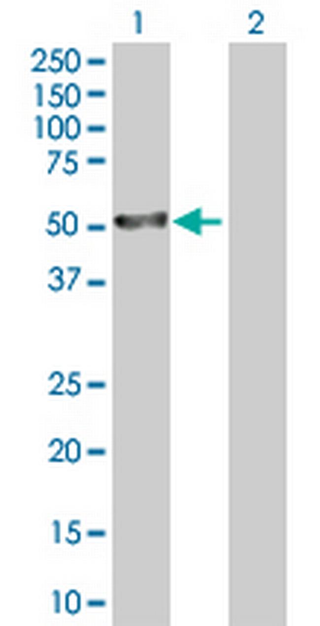 PRAME Antibody in Western Blot (WB)