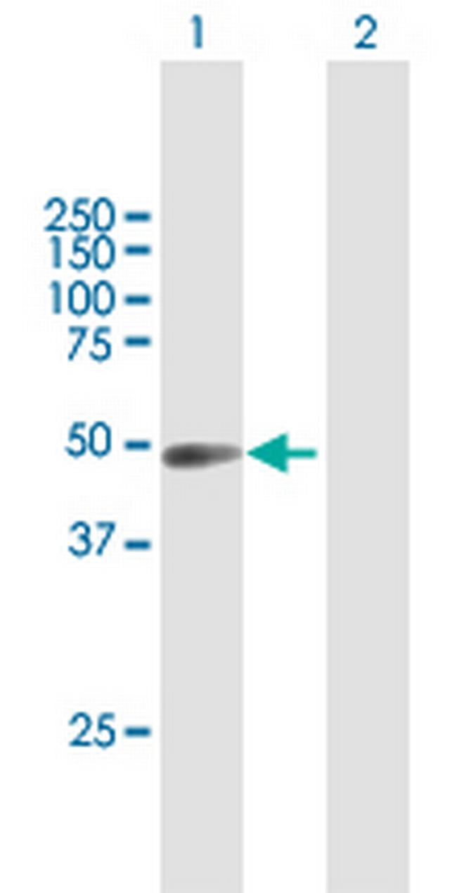 RBM9 Antibody in Western Blot (WB)