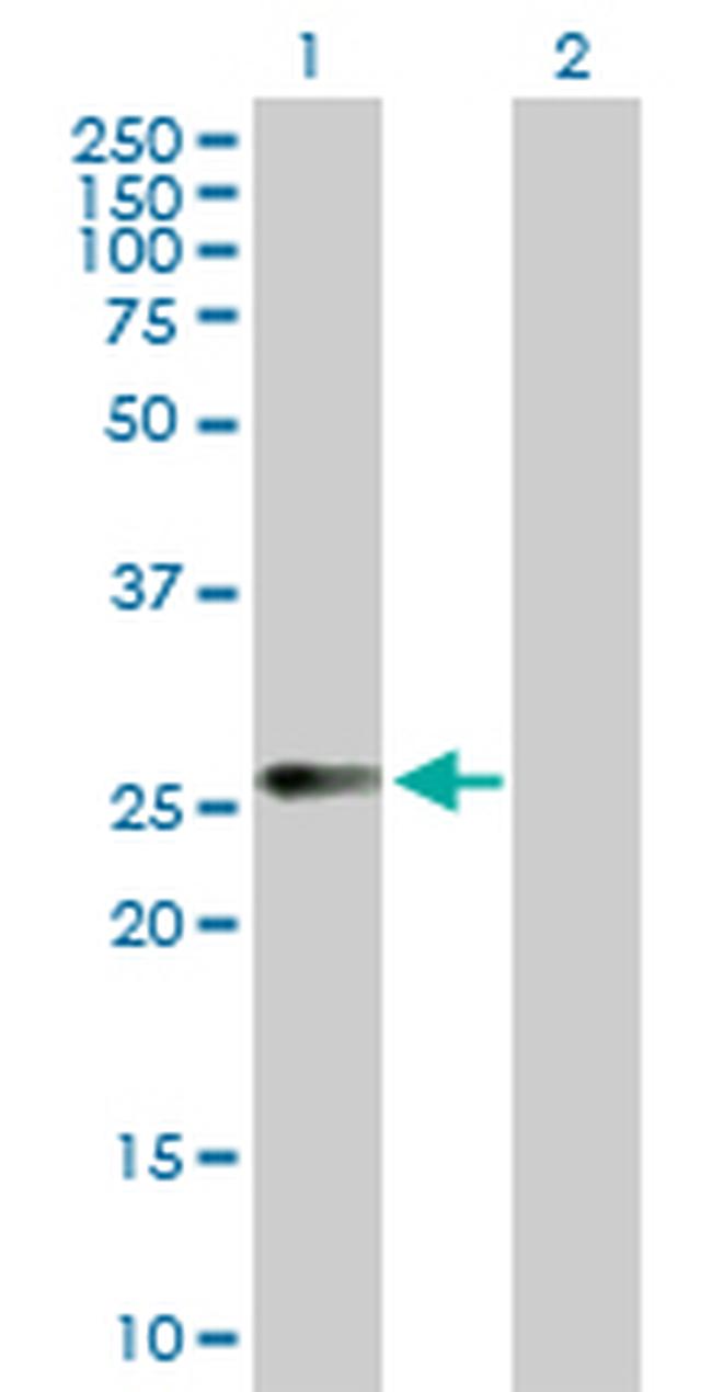 CCRK Antibody in Western Blot (WB)
