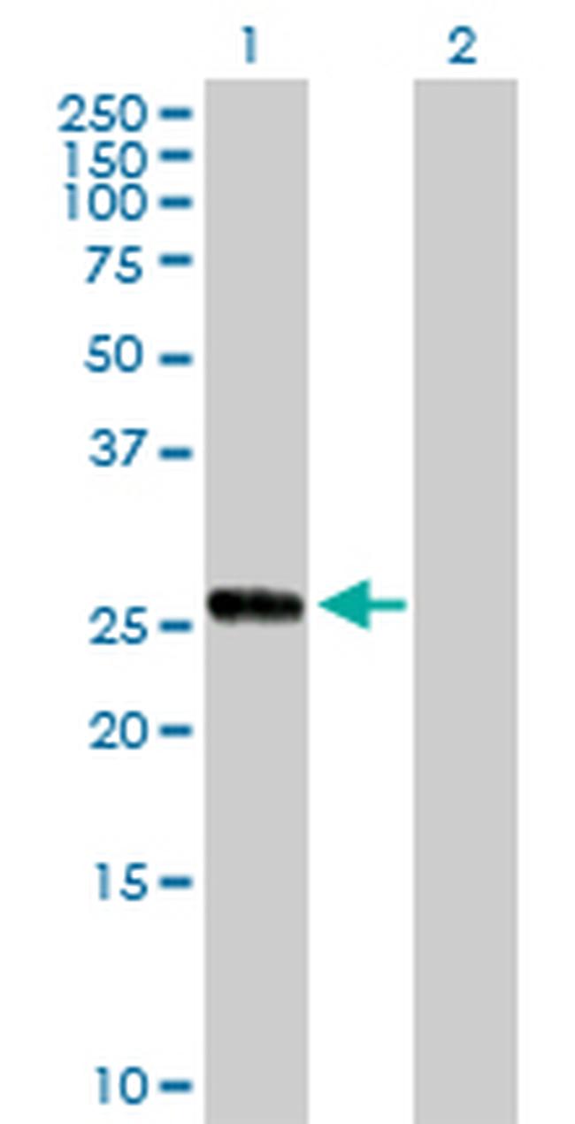CCRK Antibody in Western Blot (WB)