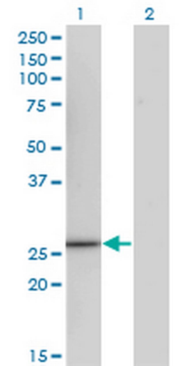 CCRK Antibody in Western Blot (WB)