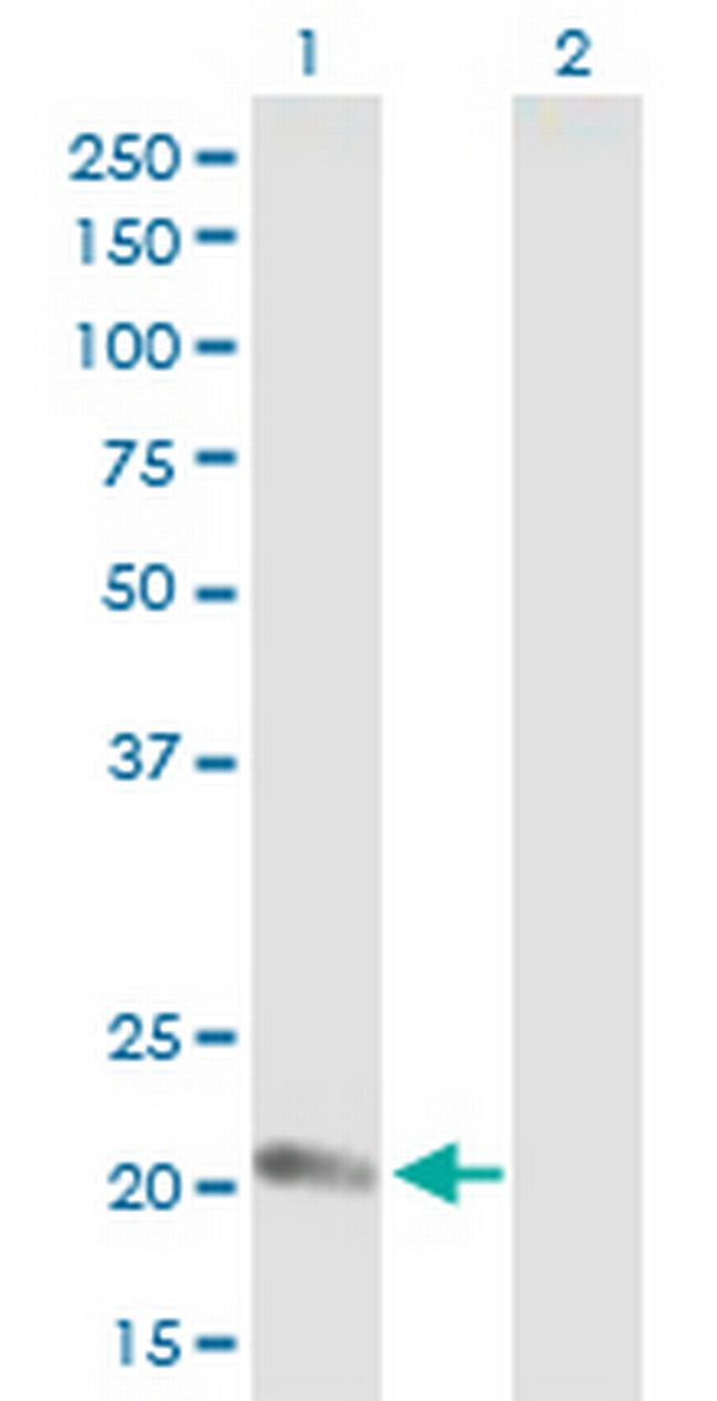 CLDN14 Antibody in Western Blot (WB)
