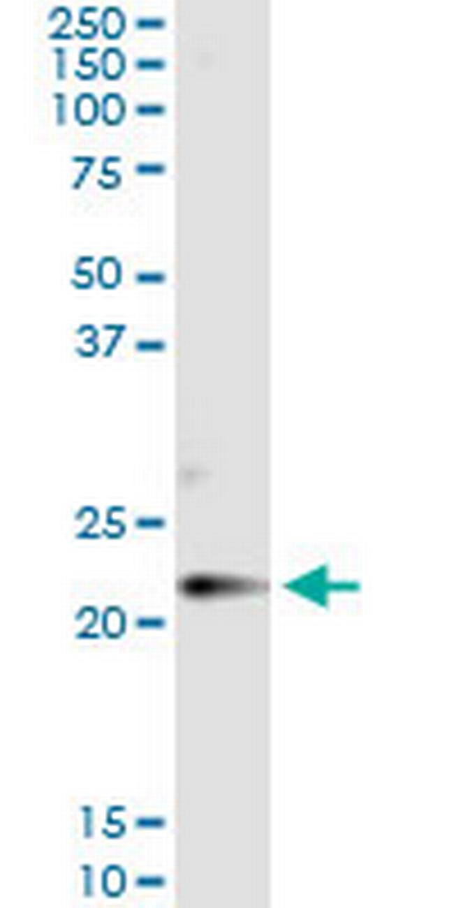 CLDN14 Antibody in Immunoprecipitation (IP)