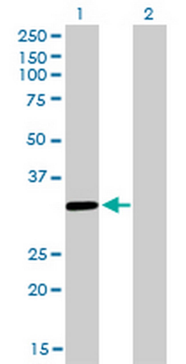 ZNF346 Antibody in Western Blot (WB)