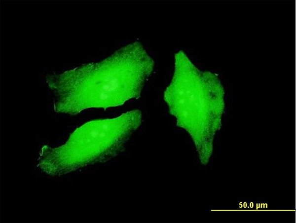 PADI4 Antibody in Immunocytochemistry (ICC/IF)