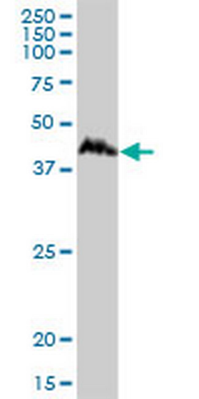 CCNDBP1 Antibody in Western Blot (WB)