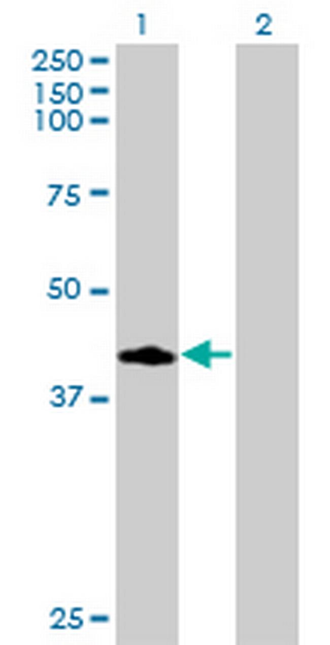 CCNDBP1 Antibody in Western Blot (WB)