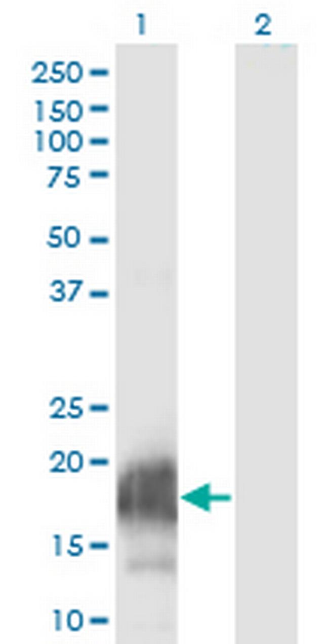 CARHSP1 Antibody in Western Blot (WB)