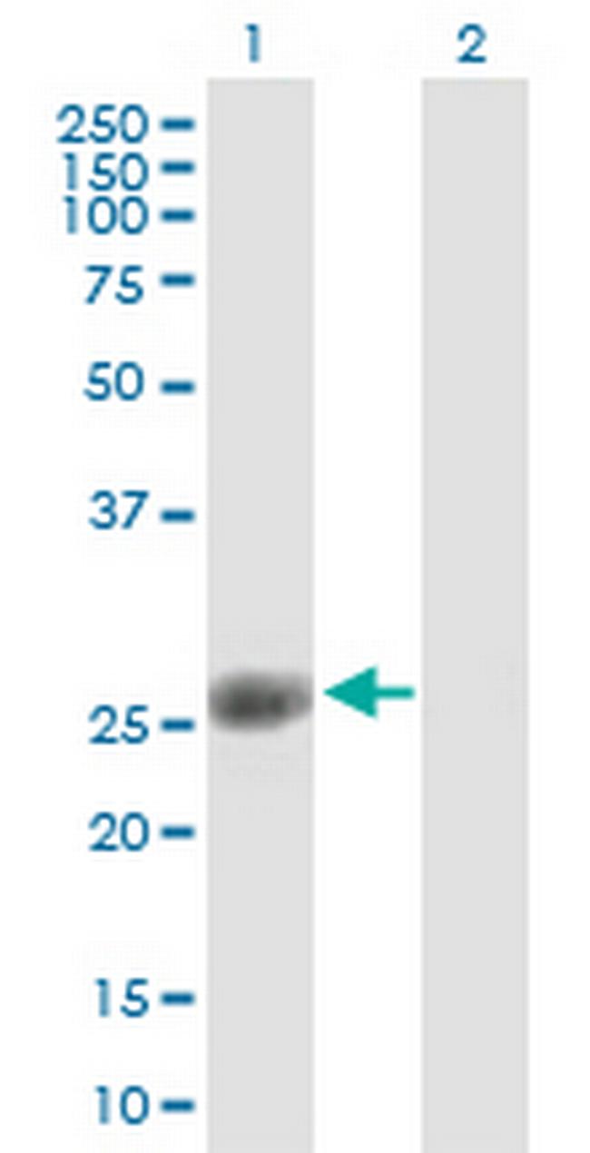 ORC6L Antibody in Western Blot (WB)
