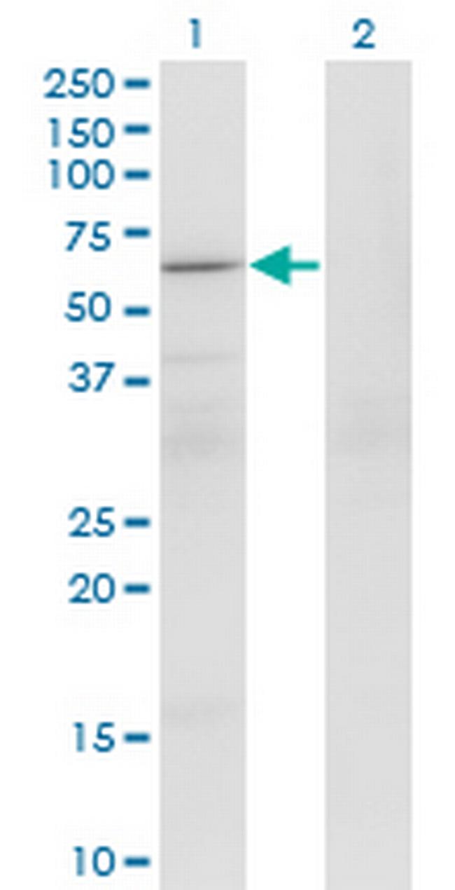 PATZ1 Antibody in Western Blot (WB)