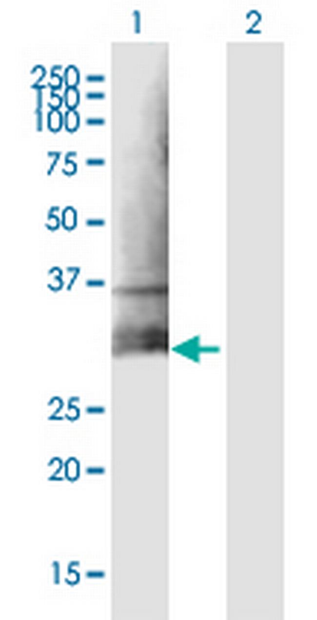 CLEC5A Antibody in Western Blot (WB)