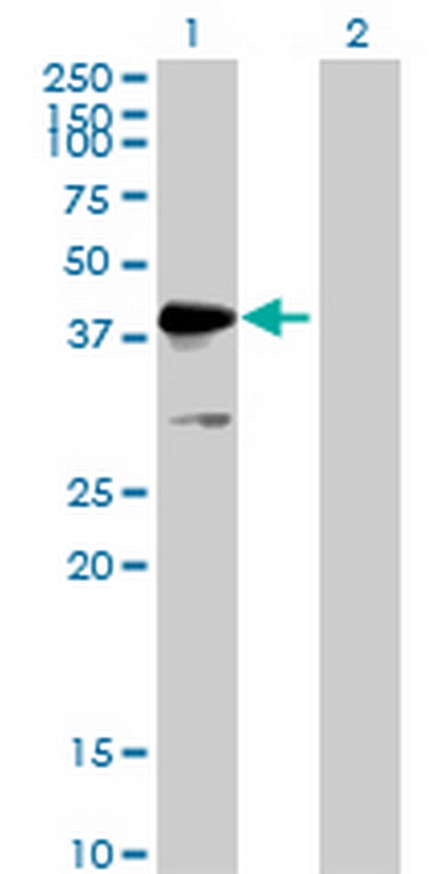 MKRN2 Antibody in Western Blot (WB)