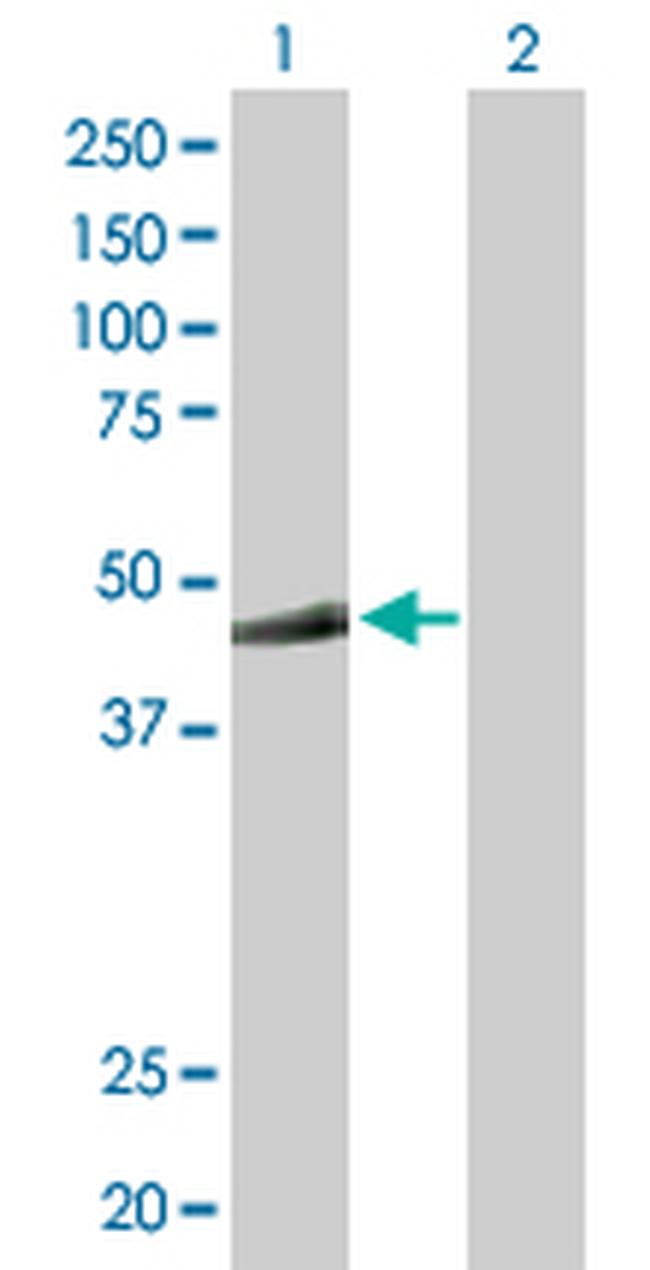 MKRN2 Antibody in Western Blot (WB)