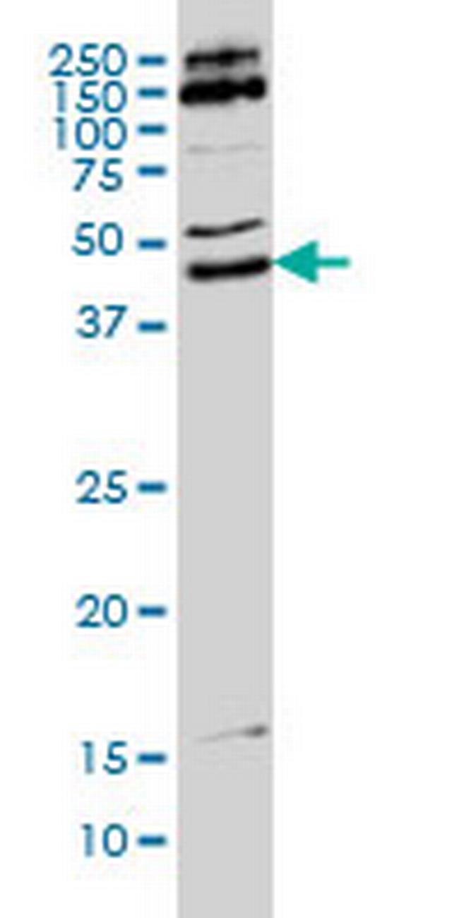 MKRN2 Antibody in Western Blot (WB)