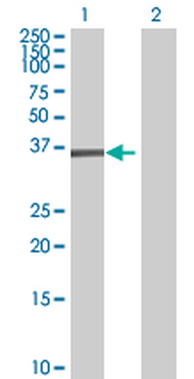 TSSK2 Antibody in Western Blot (WB)