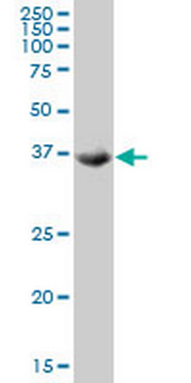 TSSK2 Antibody in Western Blot (WB)