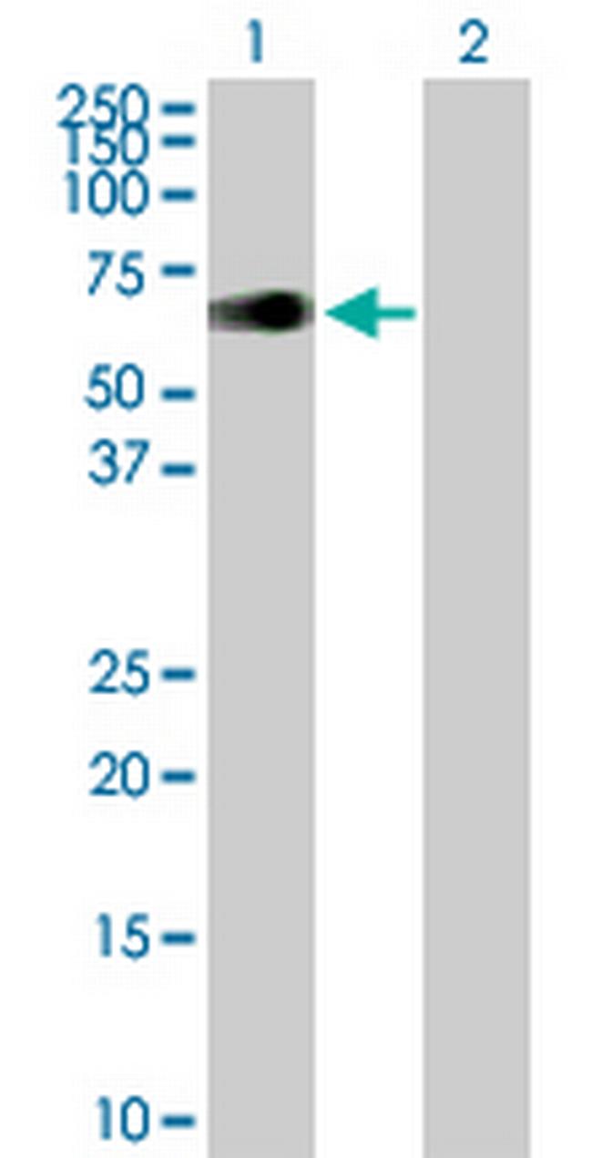 ZIM2 Antibody in Western Blot (WB)