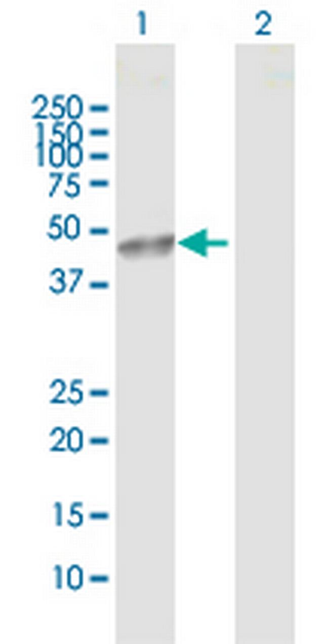 CBLC Antibody in Western Blot (WB)