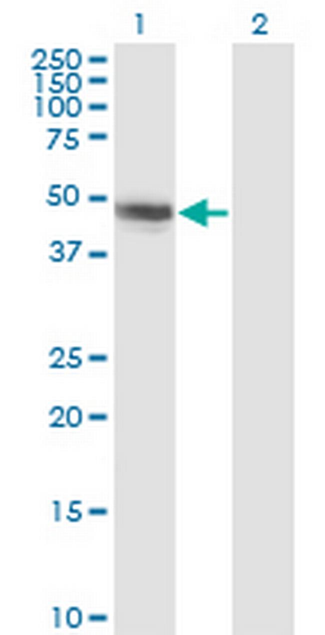 CBLC Antibody in Western Blot (WB)