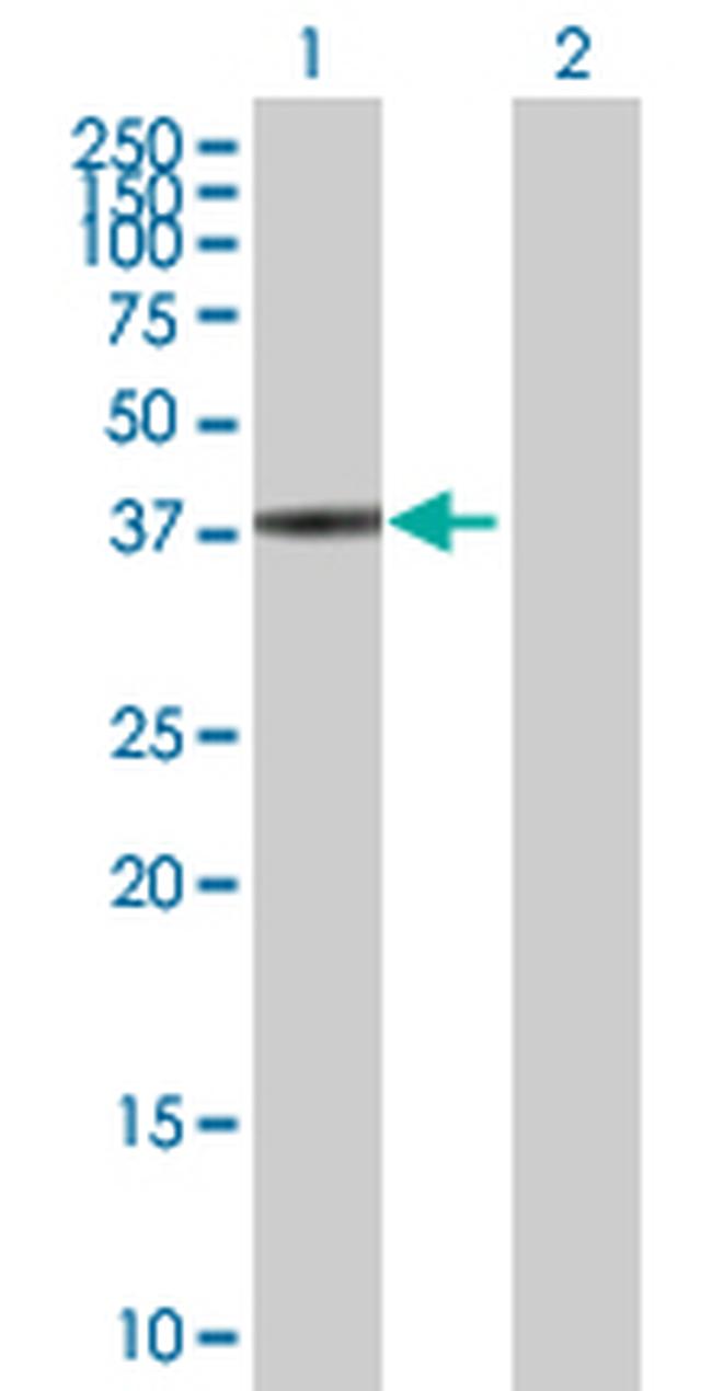 SPO11 Antibody in Western Blot (WB)
