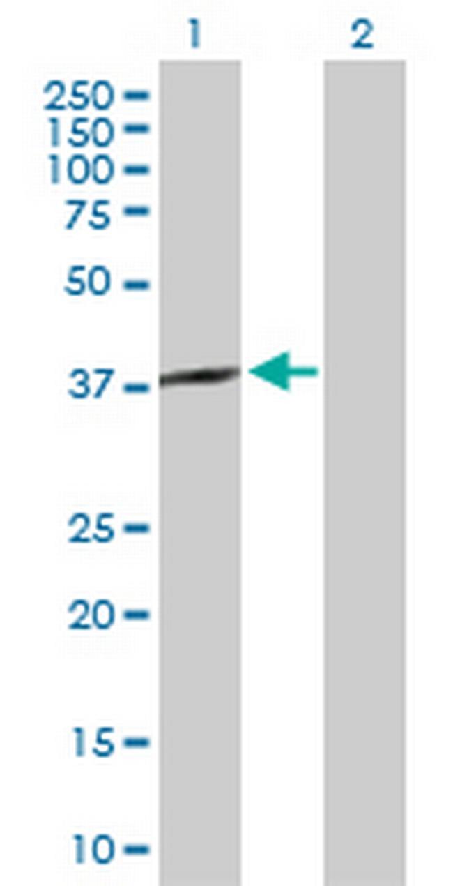 SPO11 Antibody in Western Blot (WB)