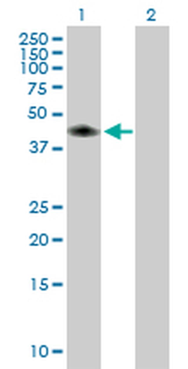 CA14 Antibody in Western Blot (WB)