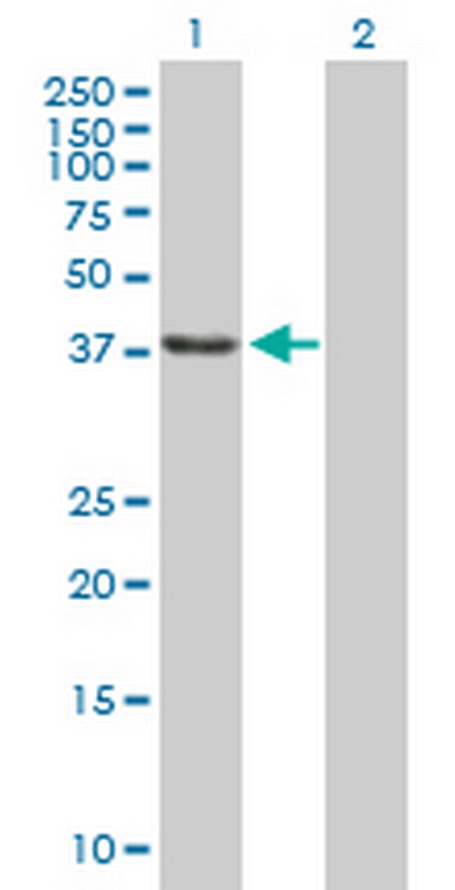 SSBP2 Antibody in Western Blot (WB)