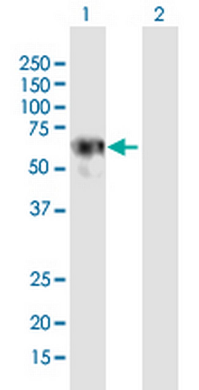 LRRC6 Antibody in Western Blot (WB)