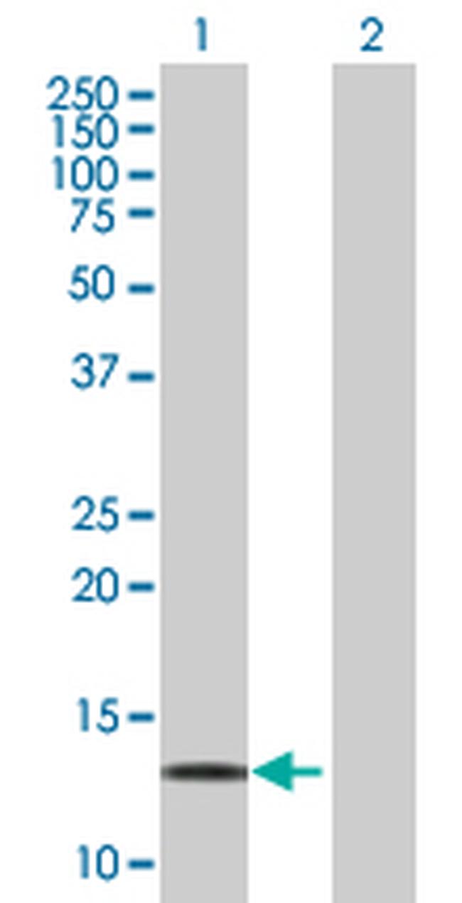 LDOC1 Antibody in Western Blot (WB)