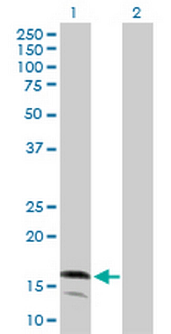 LY96 Antibody in Western Blot (WB)