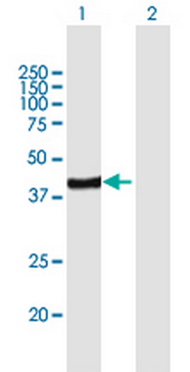 ARFIP2 Antibody in Western Blot (WB)