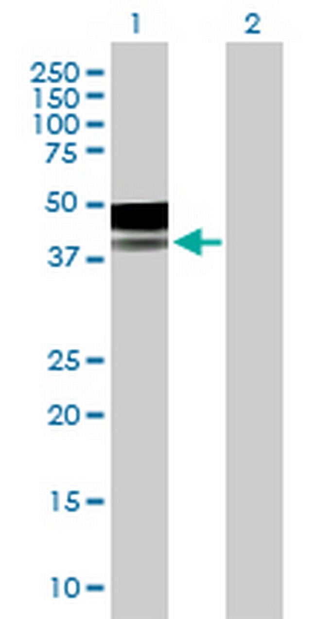 PLA2G15 Antibody in Western Blot (WB)