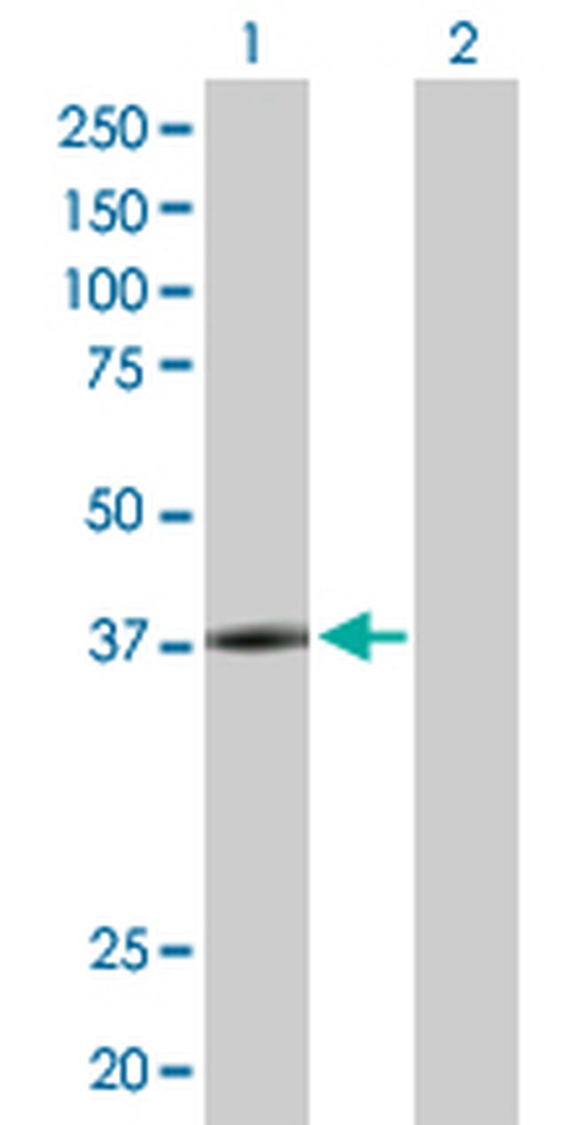 LYPLA3 Antibody in Western Blot (WB)
