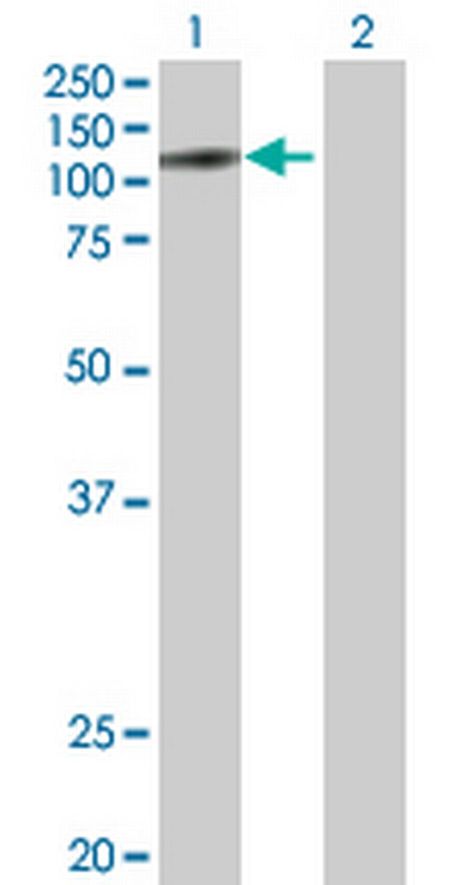 ZKSCAN5 Antibody in Western Blot (WB)