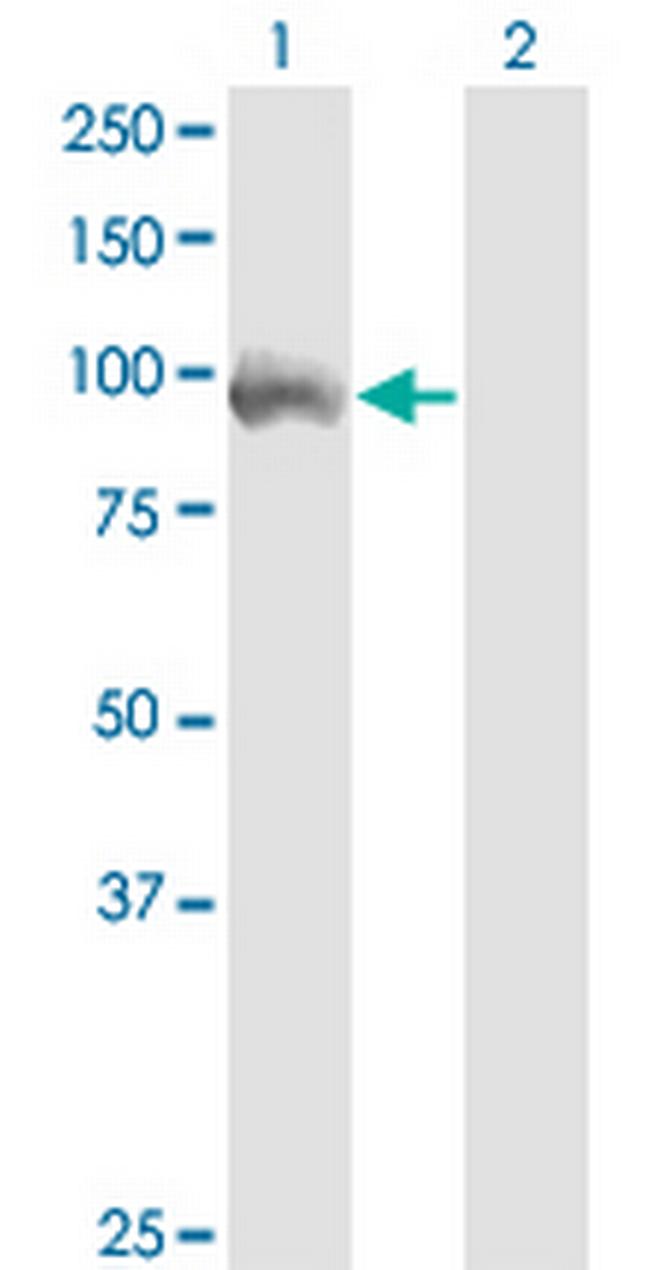 ZKSCAN5 Antibody in Western Blot (WB)