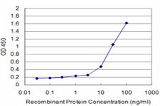 SH3BP4 Antibody in ELISA (ELISA)