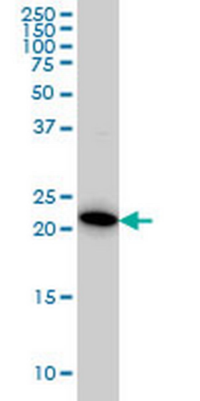 RAB38 Antibody in Western Blot (WB)