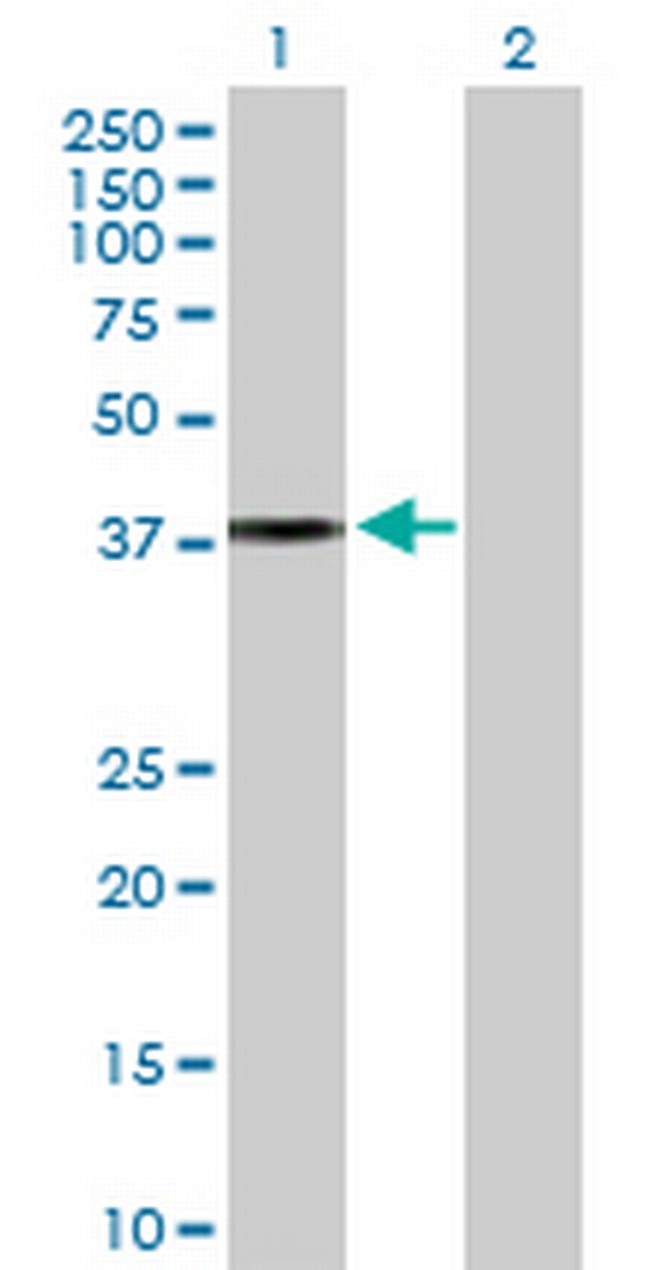 APOL2 Antibody in Western Blot (WB)