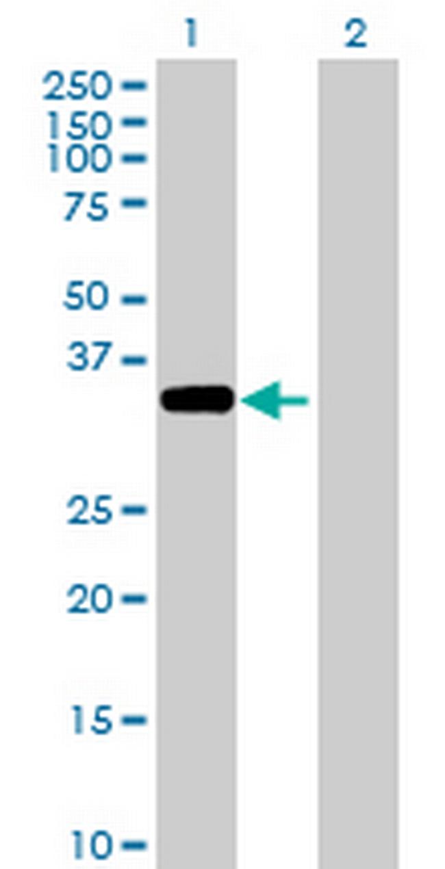 ACTBL1 Antibody in Western Blot (WB)