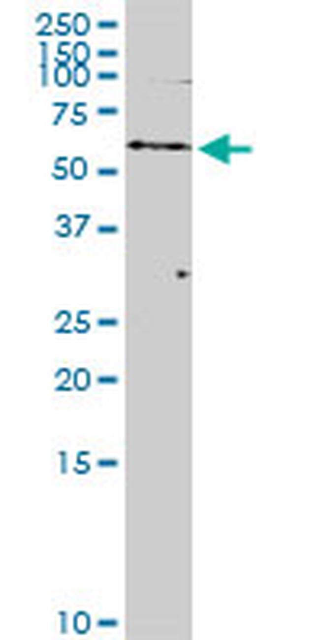 POTEH Antibody in Western Blot (WB)