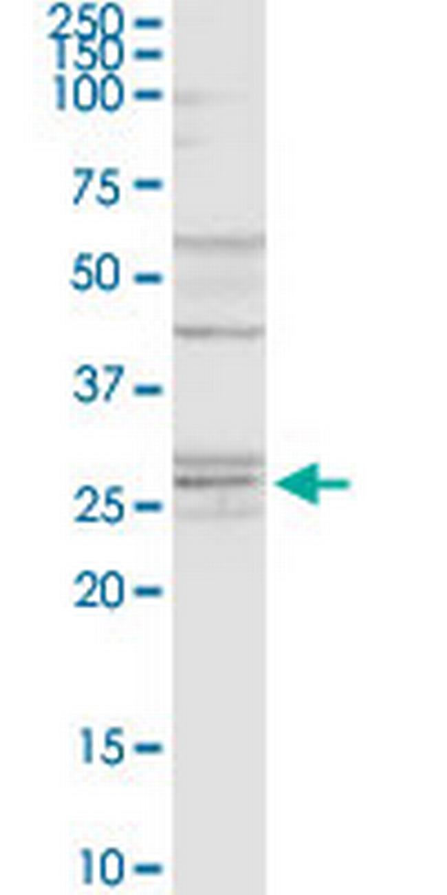 NAT6 Antibody in Western Blot (WB)