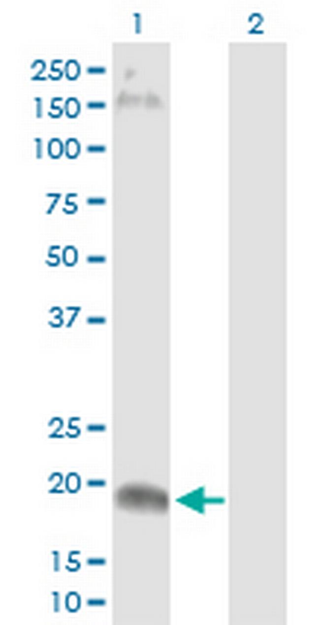 CLDN15 Antibody in Western Blot (WB)
