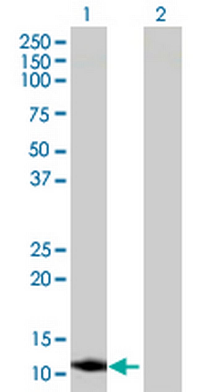 CBY1 Antibody in Western Blot (WB)